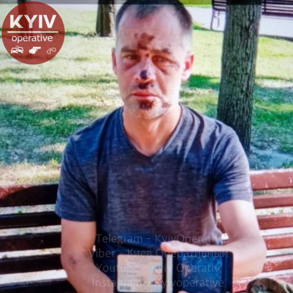 В Киеве агрессивный мужчина набросился на медиков с кинжалом и разбил «скорую»