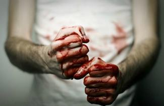 кулаки в крови, фото из открытых источников