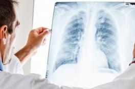 В Украине вводят новый метод лечения туберкулеза