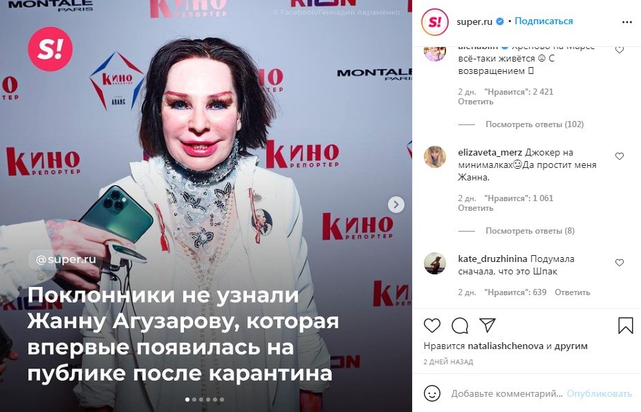 Агузарова шокировала лицом после пластики "Джокер на минималках"