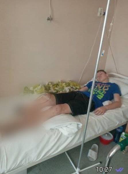 В Марганце подросток попал под колеса поезда и лишился части ноги