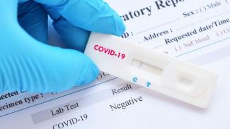 ВОЗ объявила о создании новых эффективных экспресс-тестов для выявления COVID-19