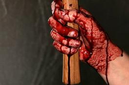 рука в крови
