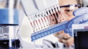 05_krov_tromboz_getty-images_wladimir-bulgar