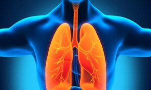 туберкулёз