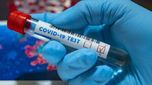 В Украине второй день – антирекорд, число зараженных Covid-19 выросло
