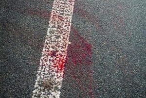 В Днепре на &quot;зебре&quot; сбит пожилой мужчина: он госпитализирован