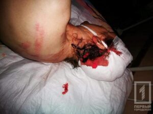 фото http://1tv.kr.ua, избиение помощника депутата