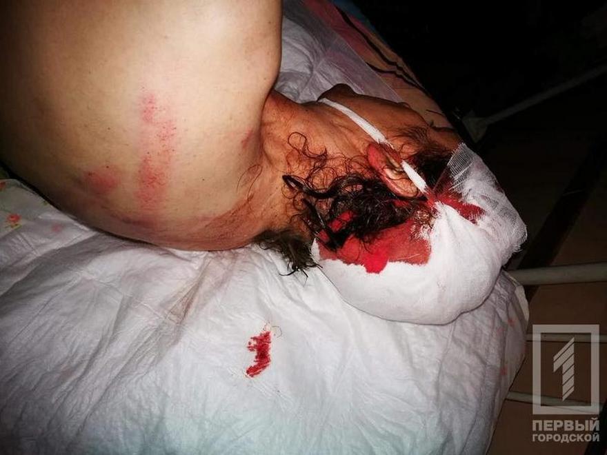 фото http://1tv.kr.ua, избиение помощника депутата