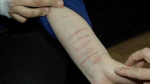 фото полиции, школьницы пытались совершить самоубийство