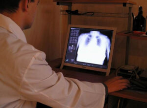 fluorografiya_tuberkulez