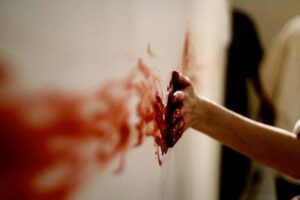 рука в крови, фото из открытых источников