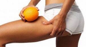 Как избавиться от целлюлита