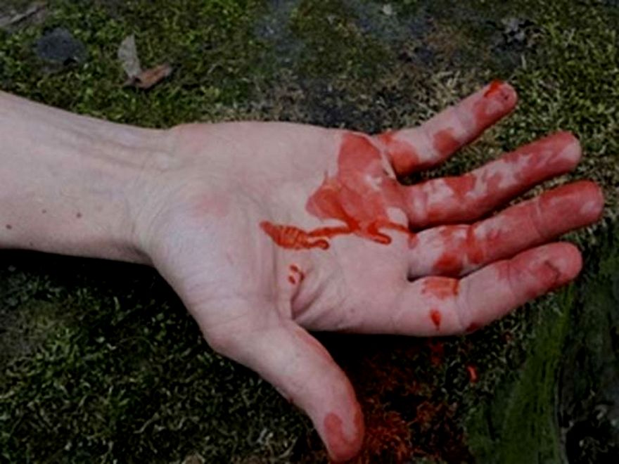 рука в крови, фото из открытых источников