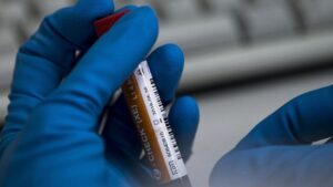Коронавирус: какая сыпь является симптомом заболевания