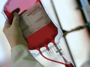 Что хорошо разжижает густую кровь: названы 7 продуктов