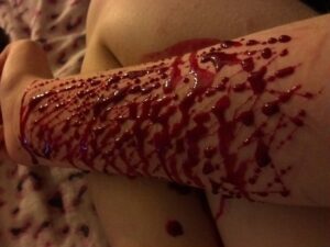 кровь на руке