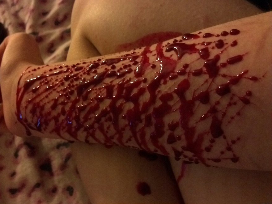 кровь на руке