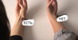 сухожилие на запястье