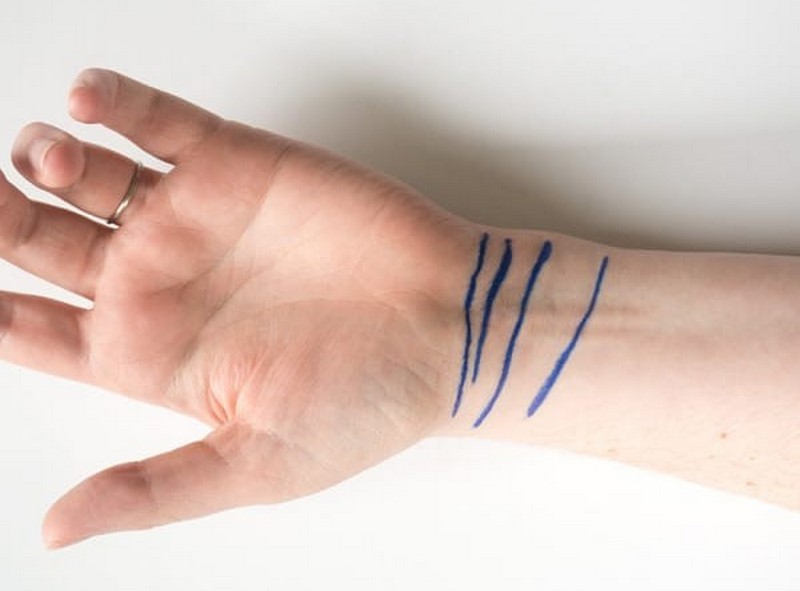 линии на запястье