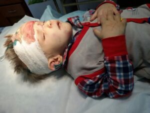 избитый мальчик, фото ГУНП