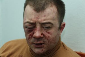нападение на юриста в Днепре