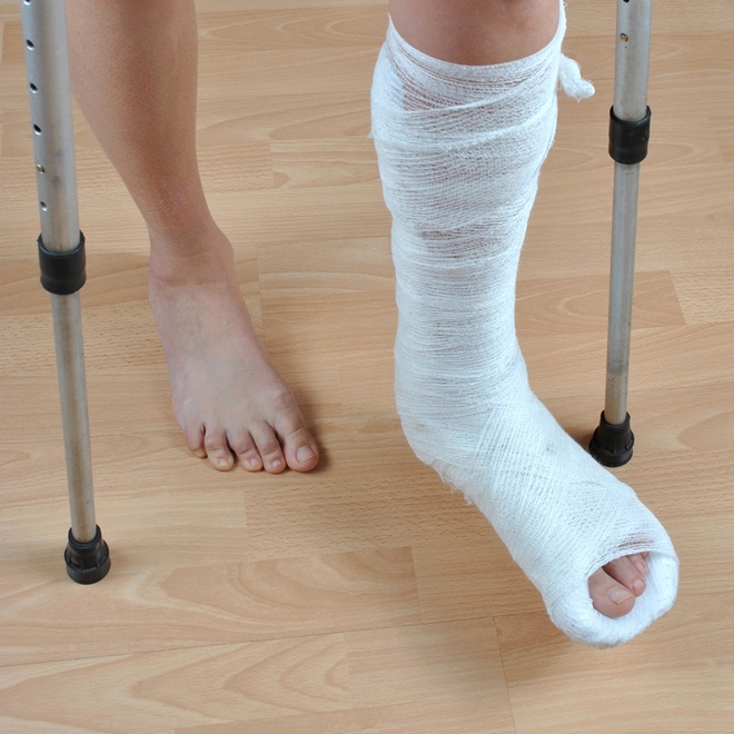 сломать ногу, фото из открытых источников