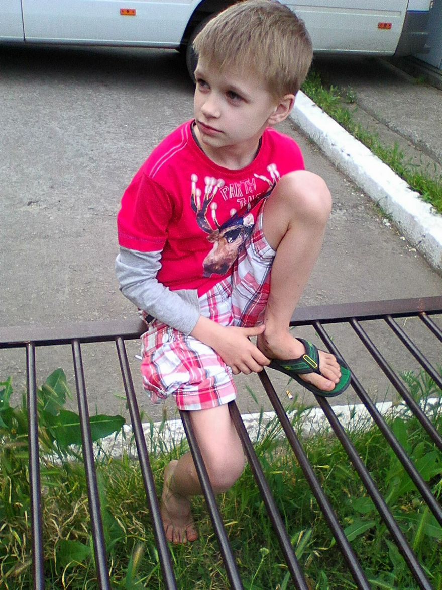 мальчик застрял в металлической конструкции