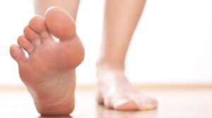 плоскостопие