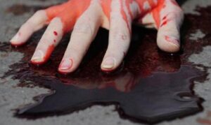 рука в крови на полу, фото из открытых источников