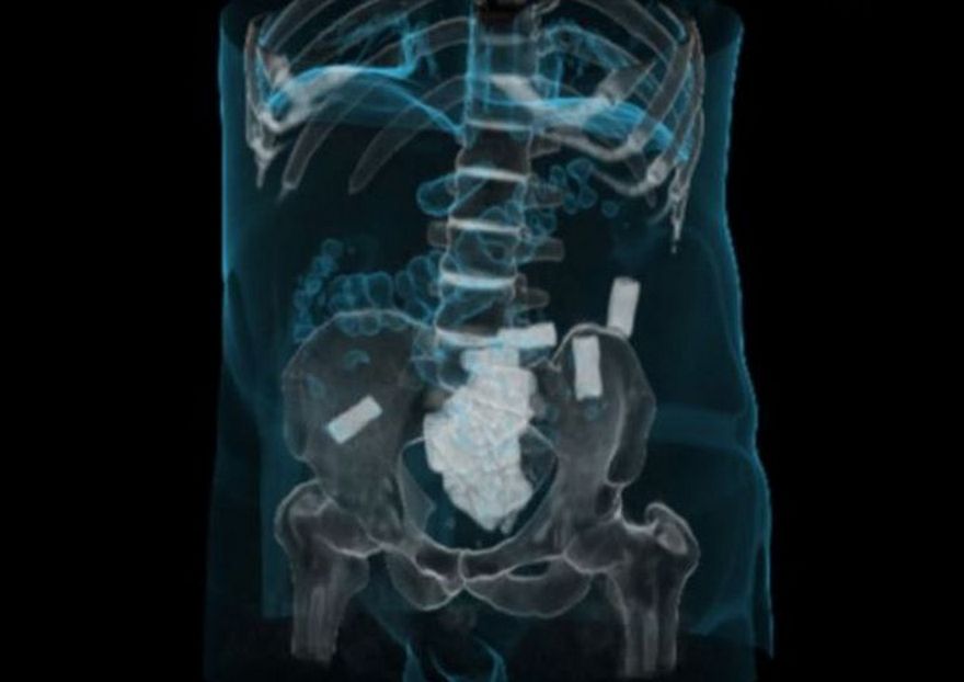 наркотики в теле, фото nevsedoma.com.ua