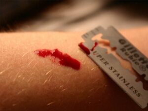 порезать вены, фото из открытых источников