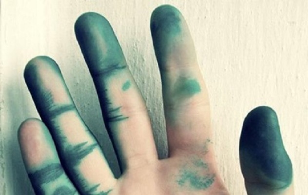 Чем смыть с кожи зеленку - проверенные способы