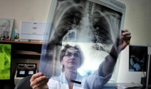 Туберкулез: как не пропустить опасную болезнь у детей и взрослых