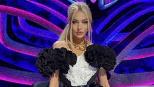 Оля Полякова показала свое лицо после “пластики”