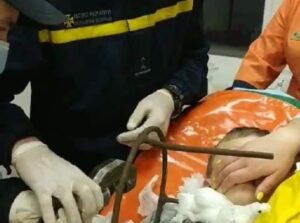 На Полтавщине 6-летний мальчик упал на металлический стул и проколол себе шею
