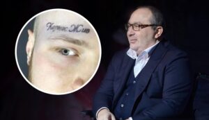 Харьковчанин убрал тату на лице в память о Геннадии Кернесе (видео)