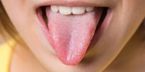 Изменения на языке могут указывать на проблемы с печенью