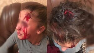 В Днепре из-за наследства повздорили два брата: пострадала 11-летняя девочка