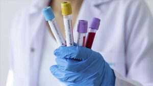 В Днепре увеличилось количество заболевших COVID-19