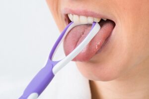 Специалисты рассказали, о каких болезнях свидетельствует налет на языке