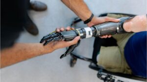 Українці можуть безкоштовно отримати протези: які документи потрібні
