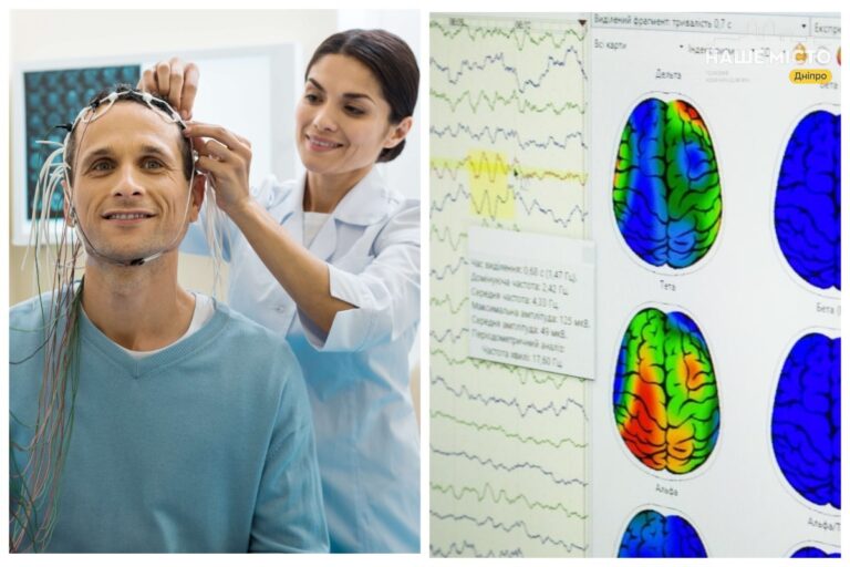 Де зробити ЕЕГ у Дніпрі: адреси клінік та ціни