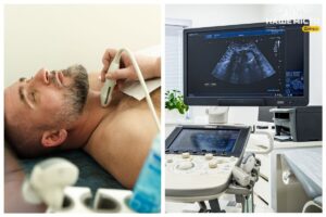 Як обрати клініку для УЗД щитоподібної залози у Дніпрі?