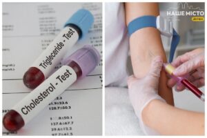 Аналіз на холестерин у Дніпрі: умови та вартість