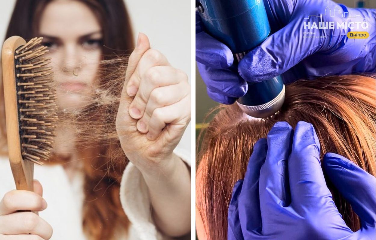 Сезонне випадіння волосся в Дніпрі: де шукати допомогу?