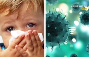 Профілактика вірусу Коксакі: поради інфекціоніста з Дніпра