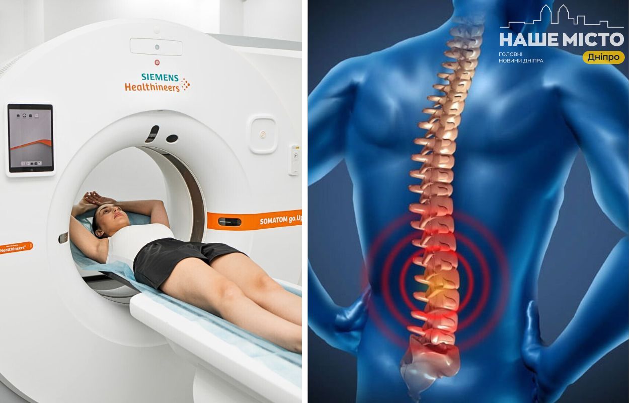 Куди звернутися для КТ хребта у Дніпрі: огляд клінік та цін