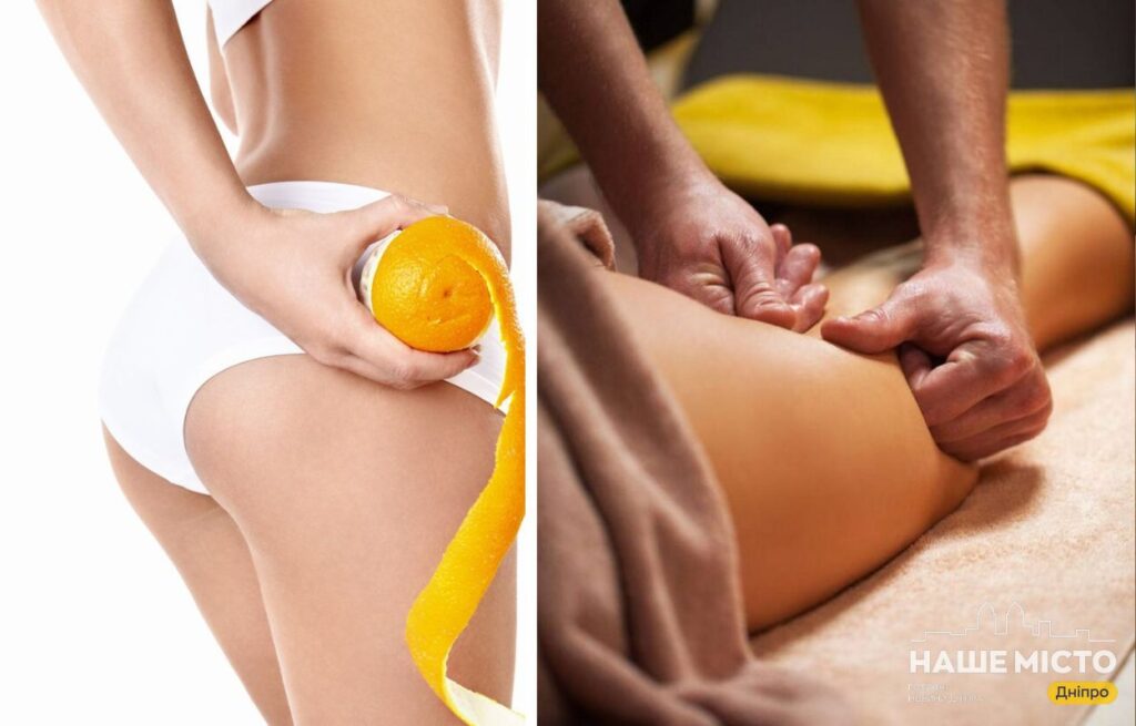 Антицелюлітний масаж у Дніпрі: курси та ціни