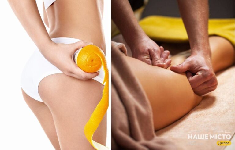 Антицелюлітний масаж у Дніпрі: курси та ціни